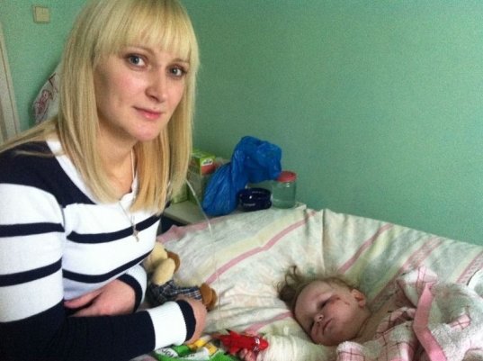 Кожу маленькой добропольчанки сожгла инфекция, фото-1 Кожу маленькой добропольчанки сожгла инфекция, фото-1