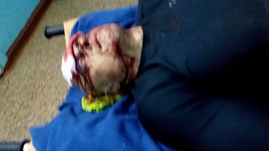 В центре Одессы жестоко избили предпринимателя: Гордиенко обещает жестоко отомстить (ФОТО) (фото) - фото 1 В центре Одессы жестоко избили предпринимателя: Гордиенко обещает жестоко отомстить (ФОТО) (фото) - фото 1