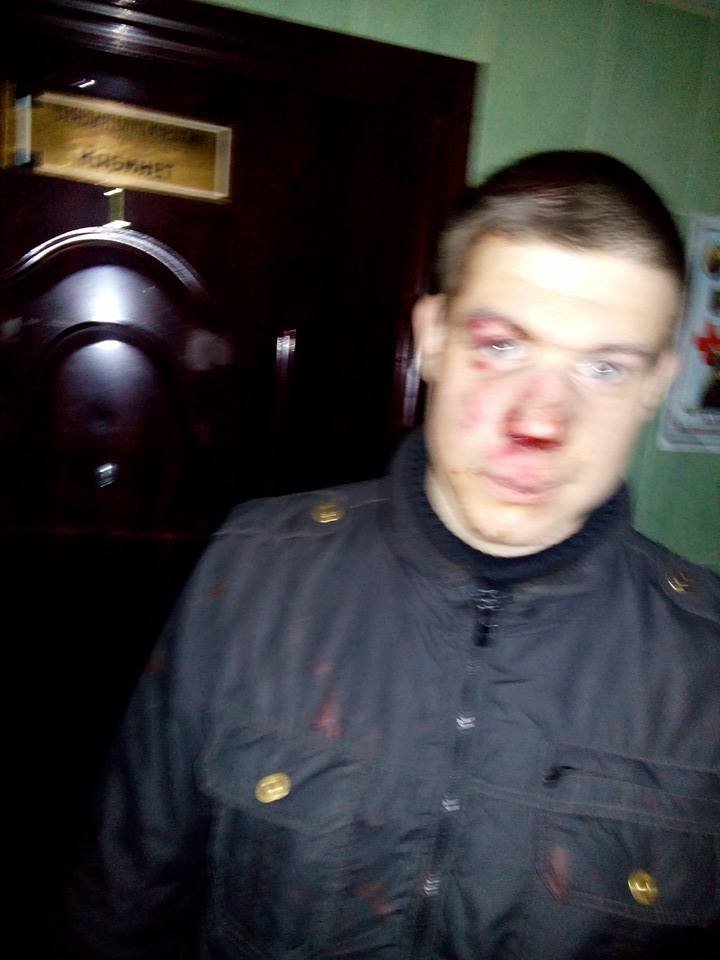 В Одессе грабители избили кастетами добровольца, который собирался в АТО (ФОТО) (фото) - фото 1 В Одессе грабители избили кастетами добровольца, который собирался в АТО (ФОТО) (фото) - фото 1
