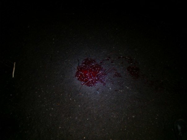 У Львові з 11-го поверху вистрибнула жінка та ... вижила (ФОТО) (фото) - фото 2 У Львові з 11-го поверху вистрибнула жінка та ... вижила (ФОТО) (фото) - фото 2