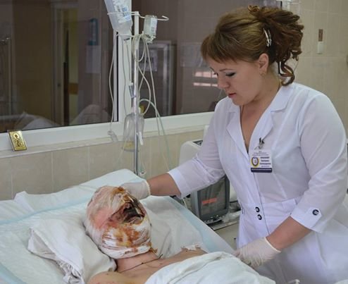 мечникова горловка мечникова горловка