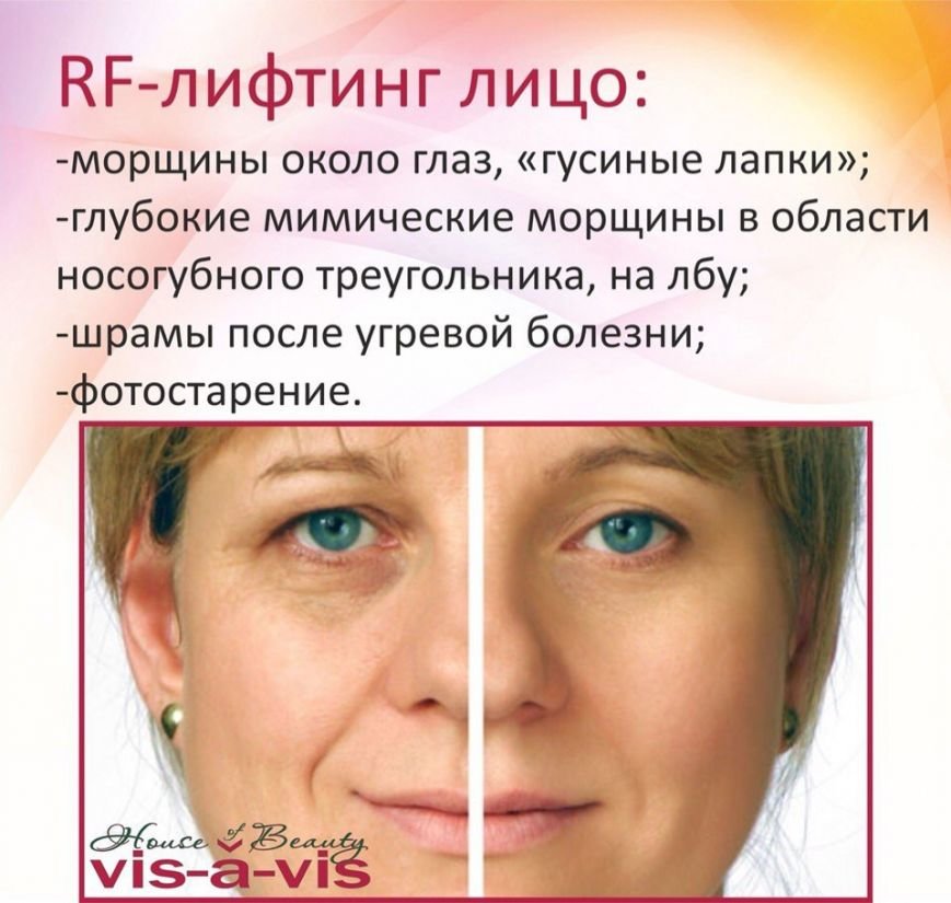 «Подготовка к лету» с Домом красоты Vis-a-Vis (фото) - фото 6 «Подготовка к лету» с Домом красоты Vis-a-Vis (фото) - фото 6