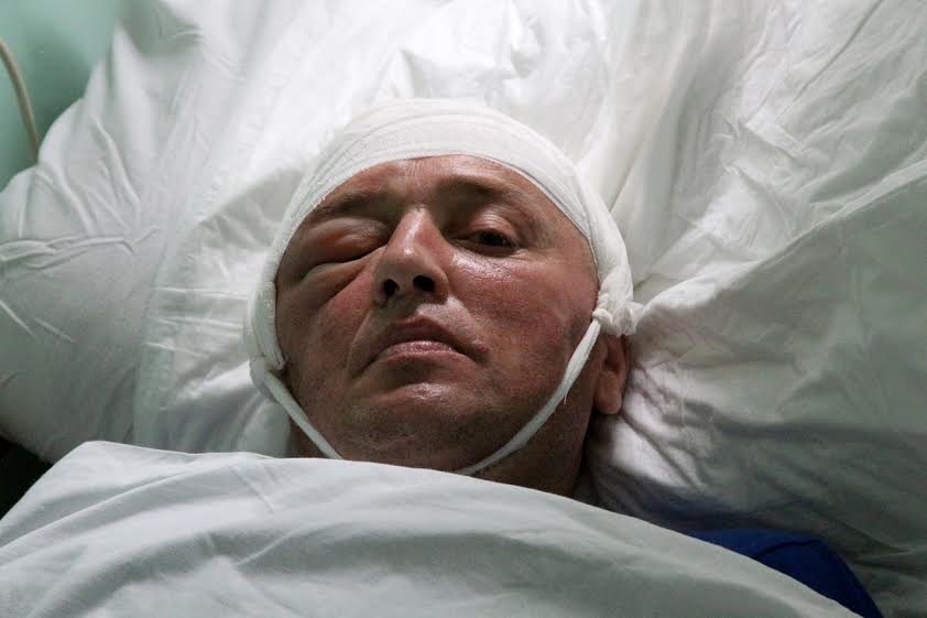 На Львівщині військові хірурги провели юнакові унікальну операцію (ФОТО) (фото) - фото 1 На Львівщині військові хірурги провели юнакові унікальну операцію (ФОТО) (фото) - фото 1
