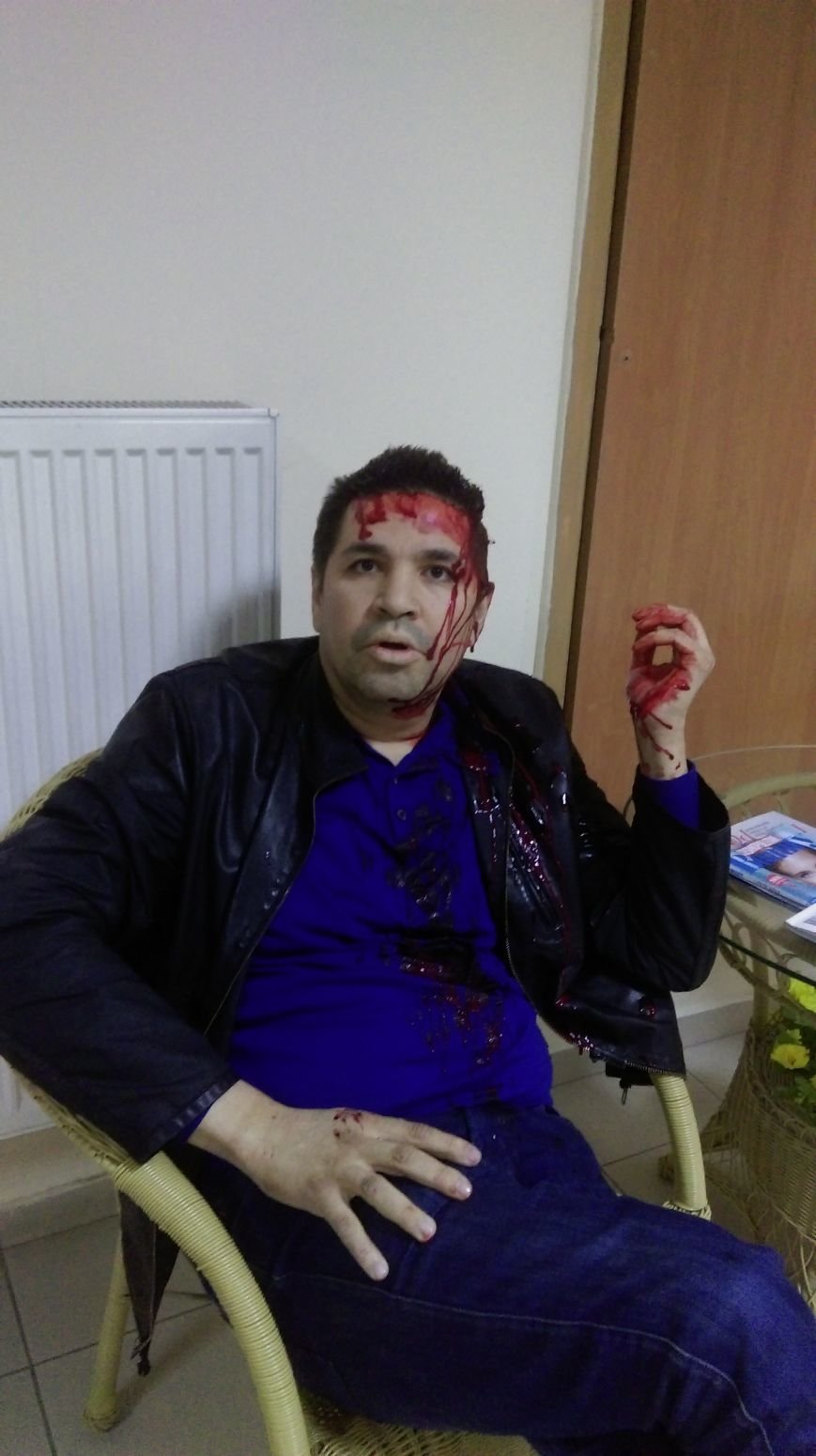 Родзинскому отказали в лечении в городской больнице за критику Кернеса в Черном Зеркале на Интер (фото) - фото 2 Родзинскому отказали в лечении в городской больнице за критику Кернеса в Черном Зеркале на Интер (фото) - фото 2