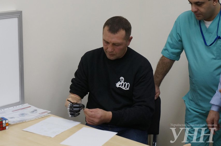 В Одессе бойцу установили протез руки, который работает с помощью сенсоров (ФОТО) (фото) - фото 1