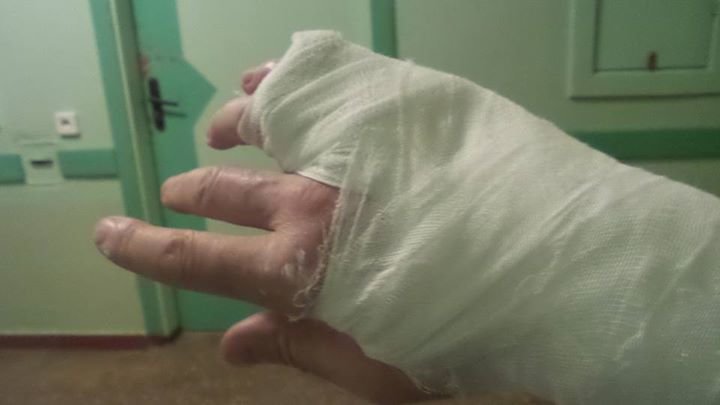 Охранники на мероприятии Владислава Атрошенко напали в Чернигове на журналиста (фото) - фото 1 Охранники на мероприятии Владислава Атрошенко напали в Чернигове на журналиста (фото) - фото 1