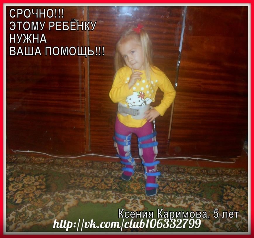 Помогите ребенку! Редкое заболевание заставляет 5-летнюю сумчанку носить обременительные доспехи (ВИДЕО) (фото) - фото 1 Помогите ребенку! Редкое заболевание заставляет 5-летнюю сумчанку носить обременительные доспехи (ВИДЕО) (фото) - фото 1