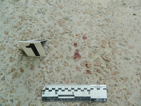 В Киеве школьника ранили ножом в живот из-за девушки (ФОТО) (фото) - фото 3 В Киеве школьника ранили ножом в живот из-за девушки (ФОТО) (фото) - фото 3