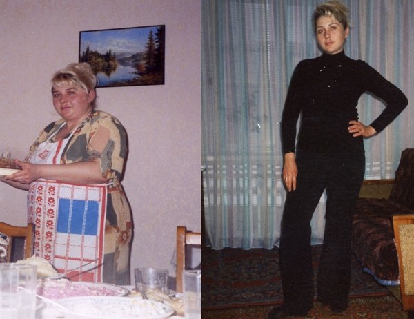 Хотите похудеть с гарантией? 7 причин обратиться к нам, в К..., фото-6 Хотите похудеть с гарантией? 7 причин обратиться к нам, в Клинику снижения веса в Мариуполе, фото-6
