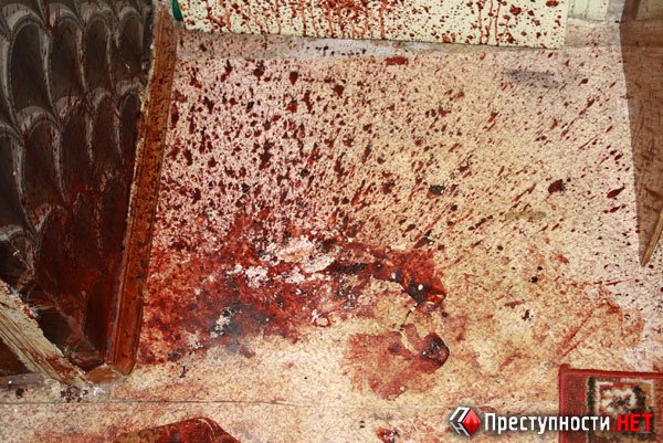 Милиция отпустила николаевцев, которые до полусмерти избили..., фото-5 Милиция отпустила николаевцев, которые до полусмерти избили парня (ФОТО), фото-5