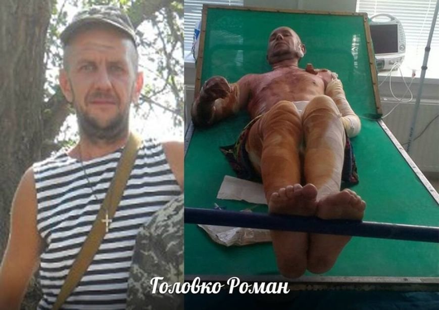 Выживший солдат 27-ого Сумского реактивного полка нуждается..., фото-2 Выживший солдат 27-ого Сумского реактивного полка нуждается в помощи (ФОТО), фото-2