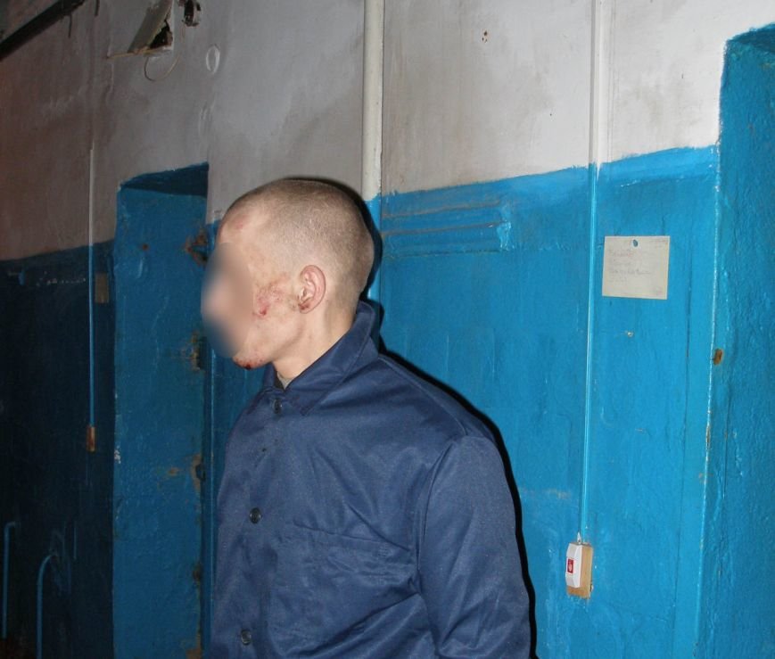 В одесском СИЗО пытали и жестоко избили заключенных (ФОТО) (фото) - фото 1 В одесском СИЗО пытали и жестоко избили заключенных (ФОТО) (фото) - фото 1