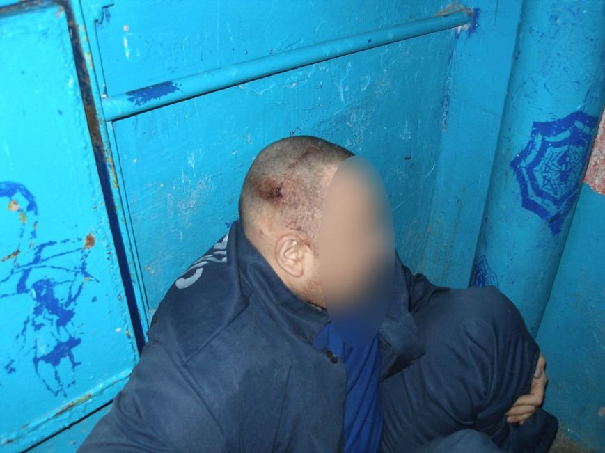 В одесском СИЗО пытали и жестоко избили заключенных (ФОТО) (фото) - фото 3 В одесском СИЗО пытали и жестоко избили заключенных (ФОТО) (фото) - фото 3