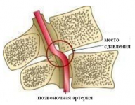 1aafc6faaf9f9336072f8800c0db4944c30c4cee_192x150