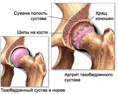 sustav11